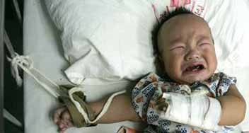 baby undergoing dialysis